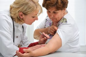 Doctor removing a tick with tweezers from skin of patient